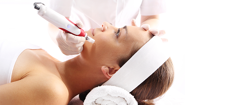 microneedling nashville