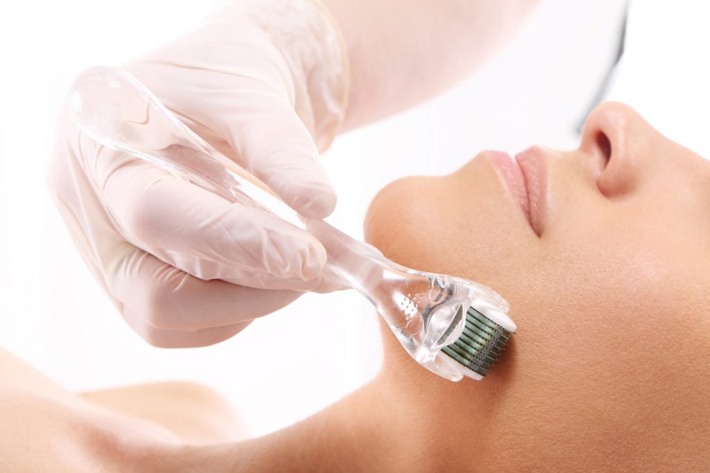 microneedling benefits