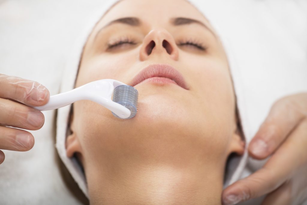 Microneedling roller on woman's chin in med spa